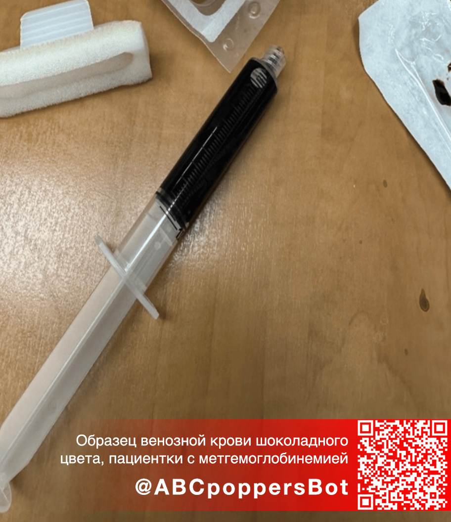 Если принять попперс внутрь в Твери это вызывает метгемоглобинемию. Смертельное состояние Если принять попперс внутрь в Твери это вызывает метгемоглобинемию. Смертельное состояние