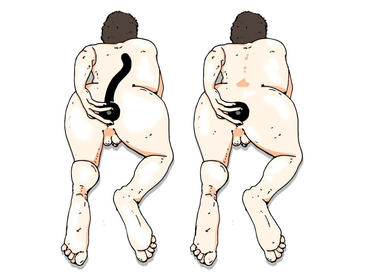 Наконец, рекомендую обзавестись так называемым тренером глубины (дип-тренер) – это должна быть совсем не толстая, но очень длинная и гибкая игрушка, введение которой в кишечник на глубину 30 см и более поможет подразнить дальний сфинктер (переход в сигмовидную кишку) и проверить, что за ним не притаилось сюрпризов. Наконец, рекомендую обзавестись так называемым тренером глубины (дип-тренер) – это должна быть совсем не толстая, но очень длинная и гибкая игрушка, введение которой в кишечник на глубину 30 см и более поможет подразнить дальний сфинктер (переход в сигмовидную кишку) и проверить, что за ним не притаилось сюрпризов.